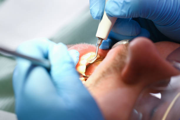 Best Same-Day Emergency Dental Services in Clarksburg, WV