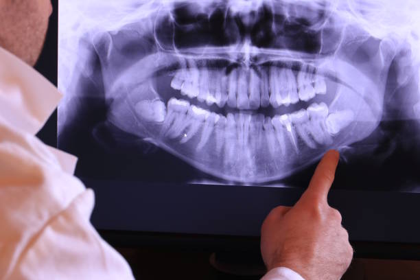 Best Emergency Gum Treatment in Clarksburg, WV
